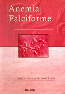 Imagem de ANEMIA FALCIFORME