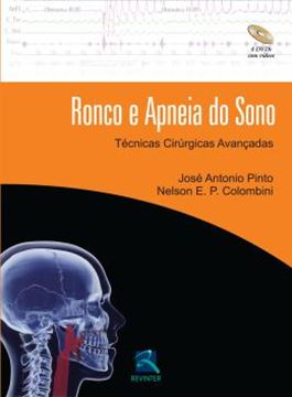 Imagem de RONCO E APNEIA DO SONO