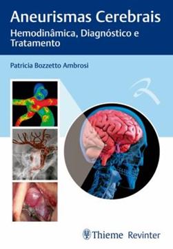 Imagem de ANEURISMAS CEREBRAIS