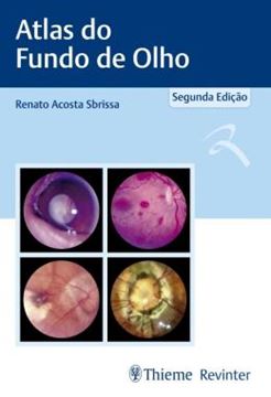 Imagem de ATLAS DE FUNDO DE OLHO - 2ª ED