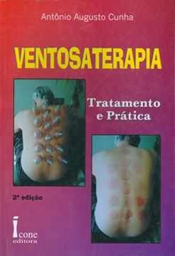 Imagem de VENTOSATERAPIA   TRATAMENTO E PRATICA 