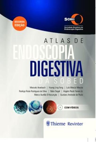 Picture of ATLAS DE ENDOSCOPIA DIGESTIVA DA SOBED