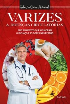 Imagem de VARIZES E DOENÇAS CIRCULATORIAS