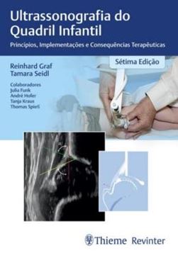 Imagem de ULTRASSONOGRAFIA DO QUADRIL INFANTIL - 7ª ED.