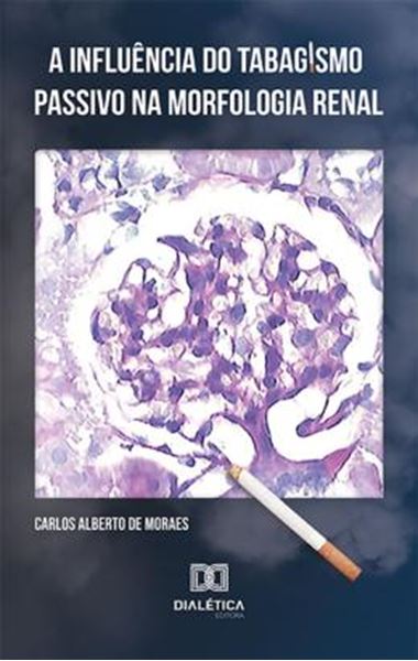 Picture of A INFLUENCIA DO TABAGISMO PASSIVO NA MORFOLOGIA RENAL